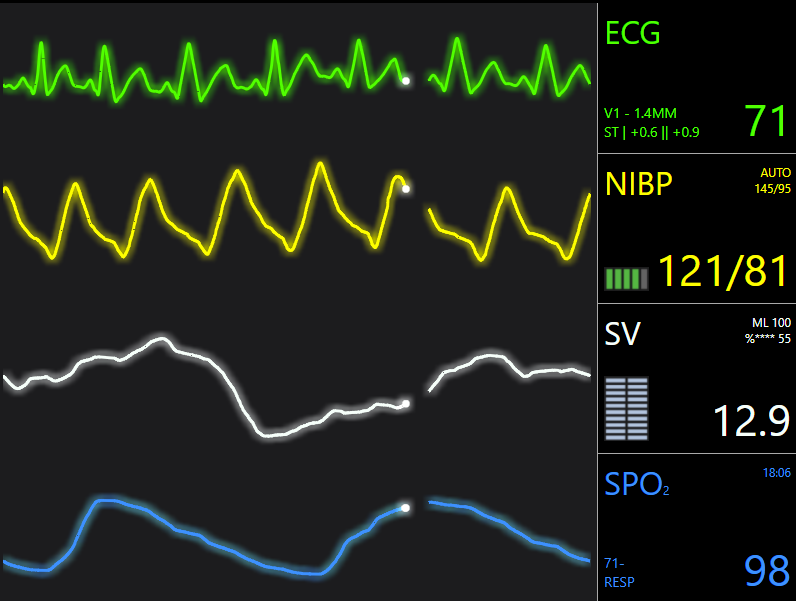 WebGL Shader effects applied to JavaScript Charts to achieve glow and dropshadow