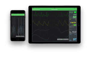 SciChart iOS Android Showcase ECG/EKG App demo
