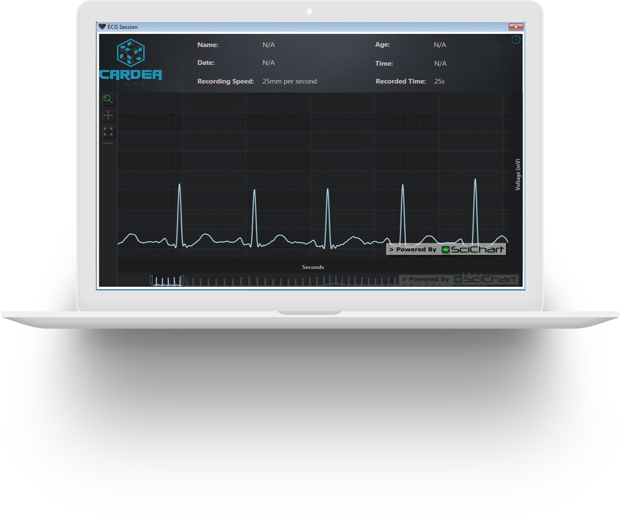 Dynamic WPF Visualization of ECG signals in Realtime