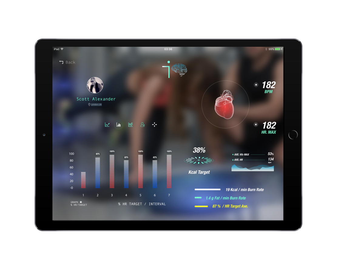 Realtime iOS Charting for Cardiac Data