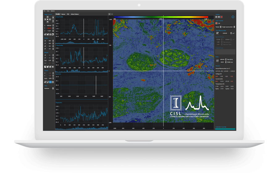 High-Definition WPF Realtime Visualization of IR QCL Spectroscopy for Diagnostic Tissue Imaging