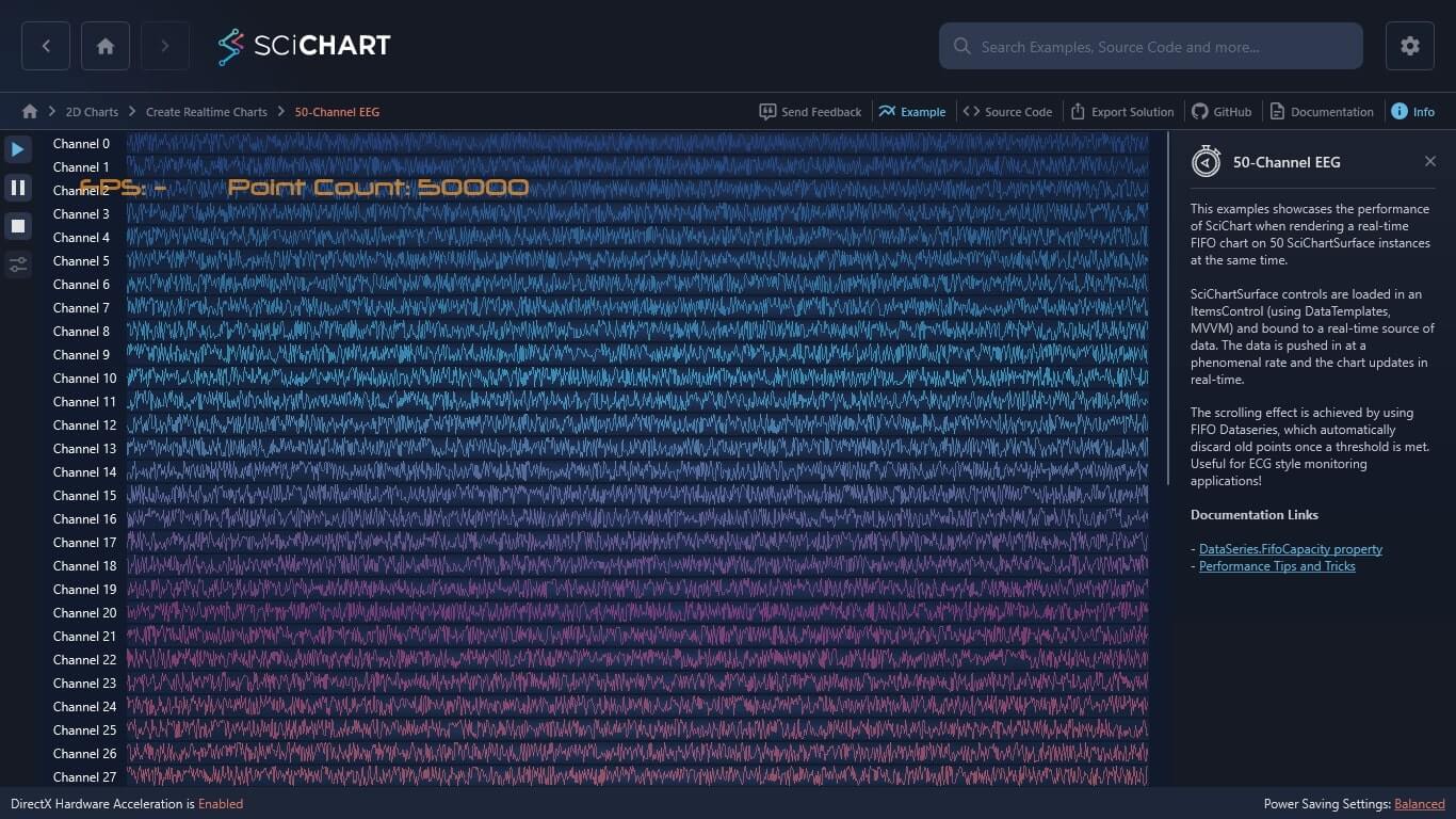A 50 channel ECG chart