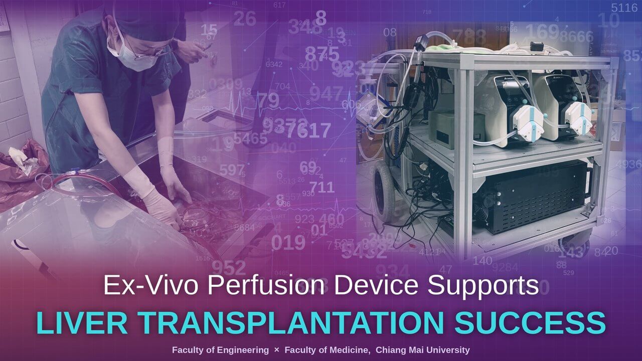 Ex-Vivo Perfusion Device for Liver Transplantation Success